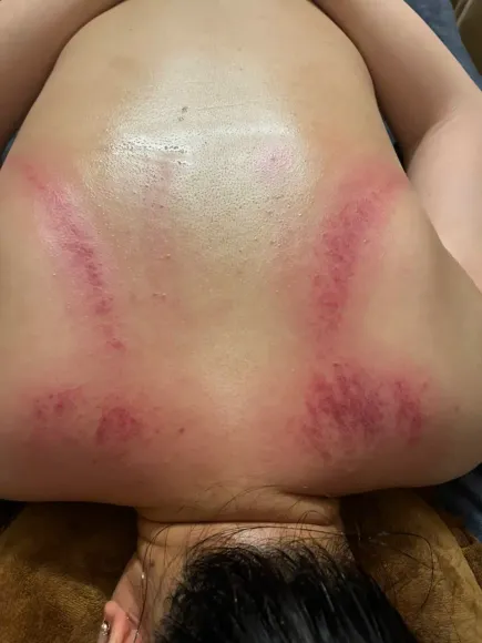 trị liệu bệnh lý